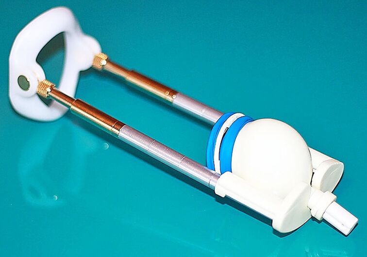 Пенисинин кеңейүүсү үчүн кеңейтүү